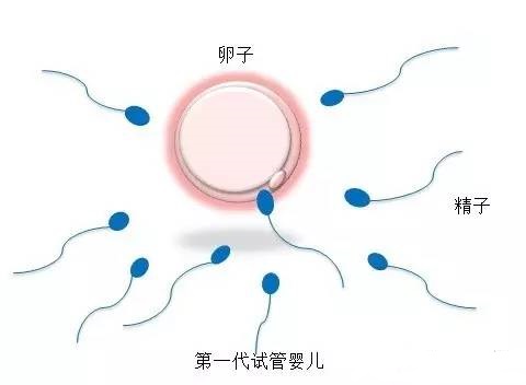 男性不育案例
